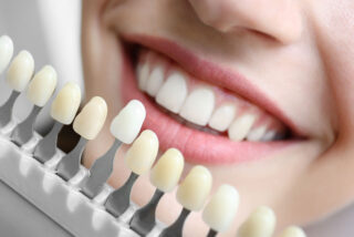 ¿Quieres dientes más blancos? Estos son los métodos seguros y los hábitos que pueden arruinar tu sonrisa